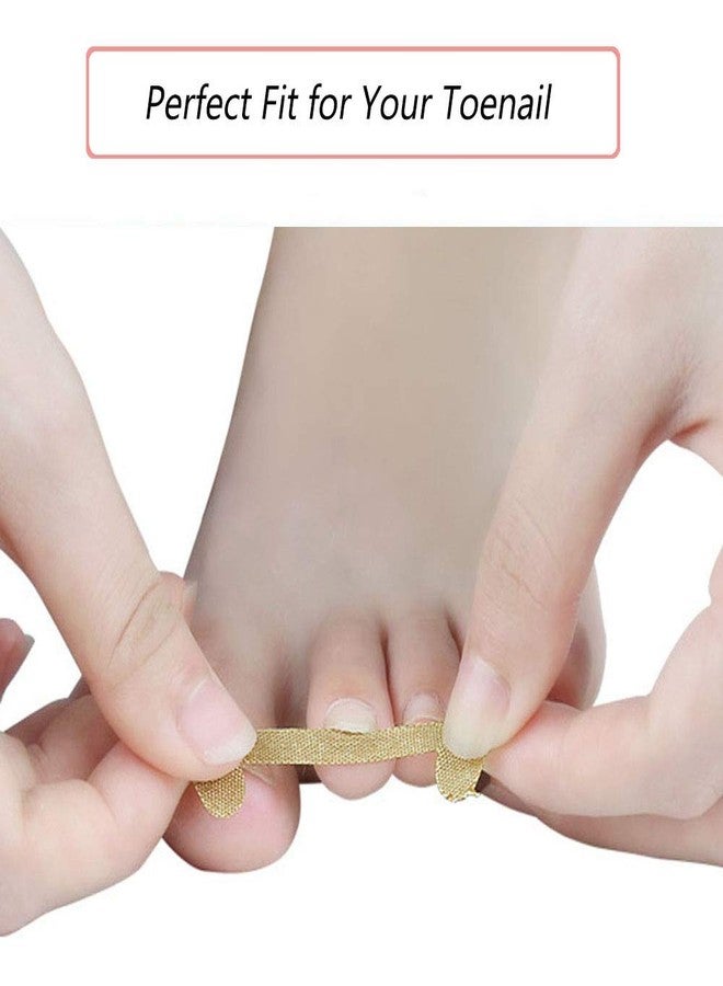 EBANKU Ingrown Toenail Treatment Strips, 20 Pcs Toe Nail Correction Patch Elastic Patch Sticker Corrector Pedicure Tools Fingernail Toe Nail Care - Image 2
